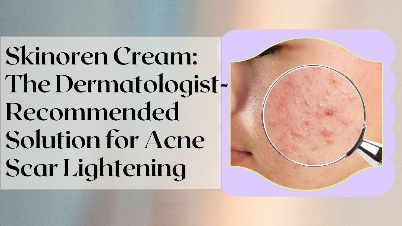 Skinoren Cream: The Dermatologist-Recommended Solution for Acne Scar Lightening